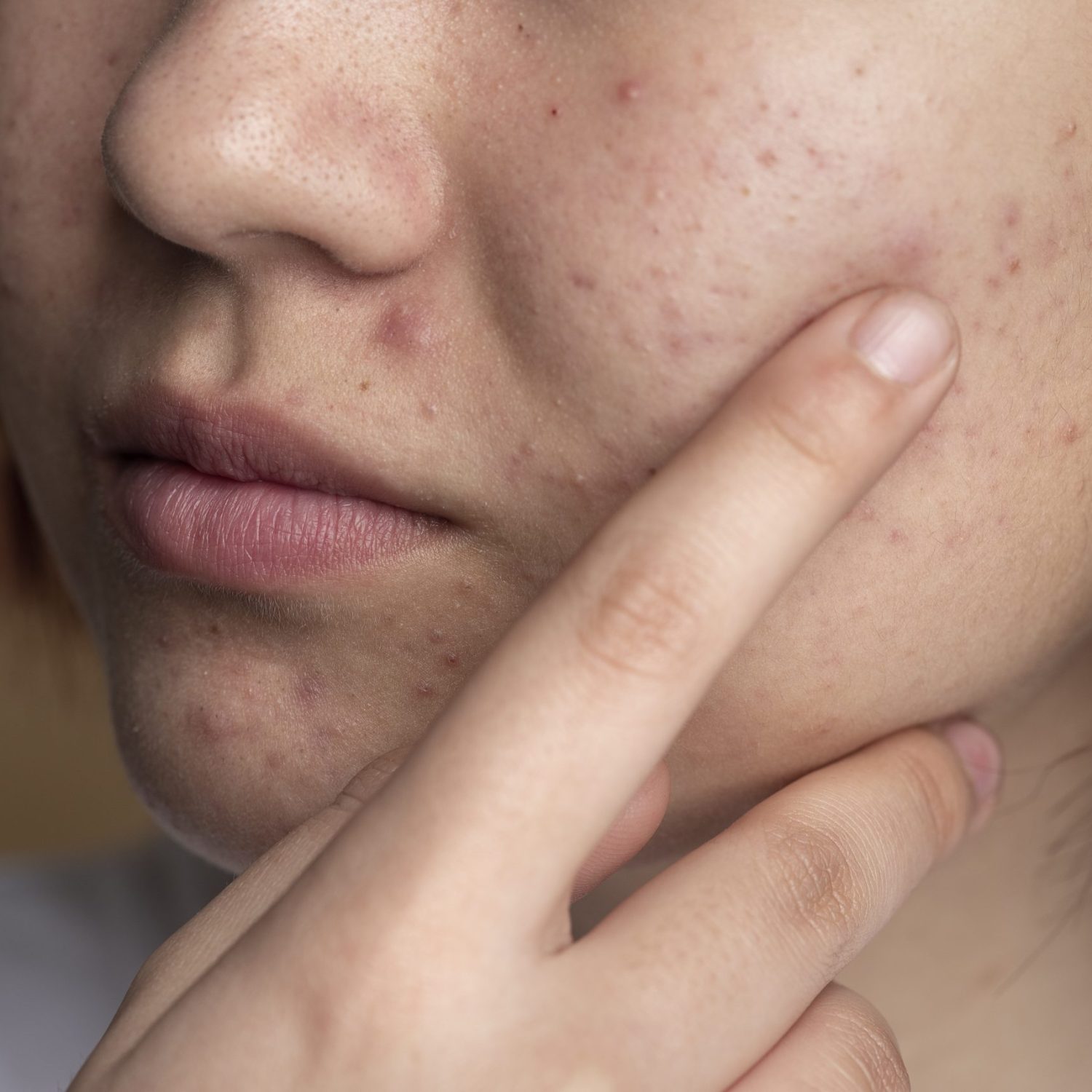 close-up-skin-pores-face-care-routine